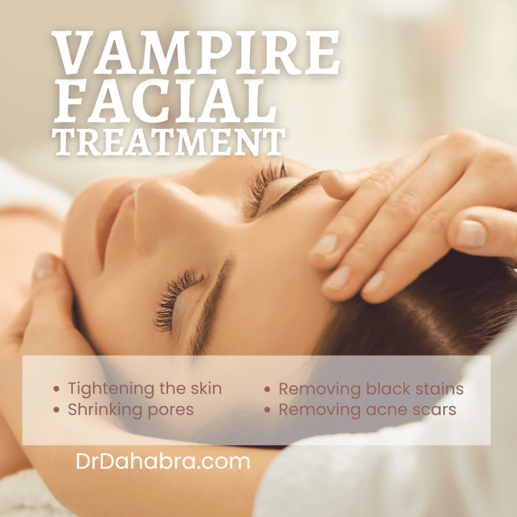 image of Vampire Facial Cost in Plantation FLoriday