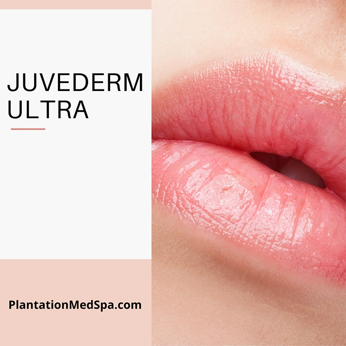 image of Juvederm Ultra Cost in Plantation Florida