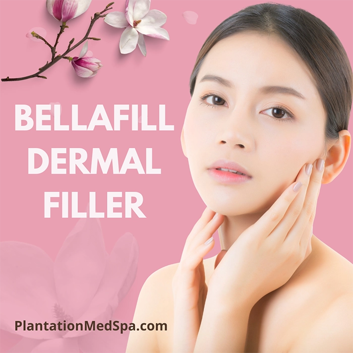 image of bellafill dermal filler cost in Plantation Florida