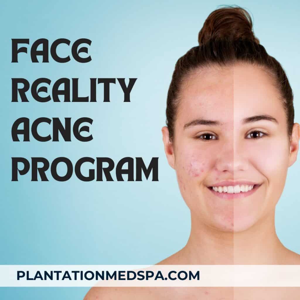 image of face reality acne program cost in Plantation Florida