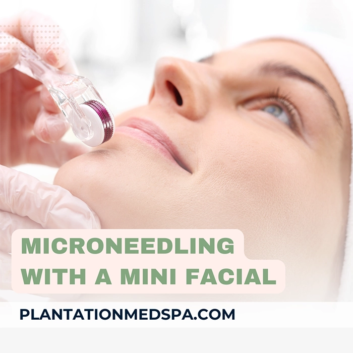 image of microneedling with a mini facial cost in Plantation Florida