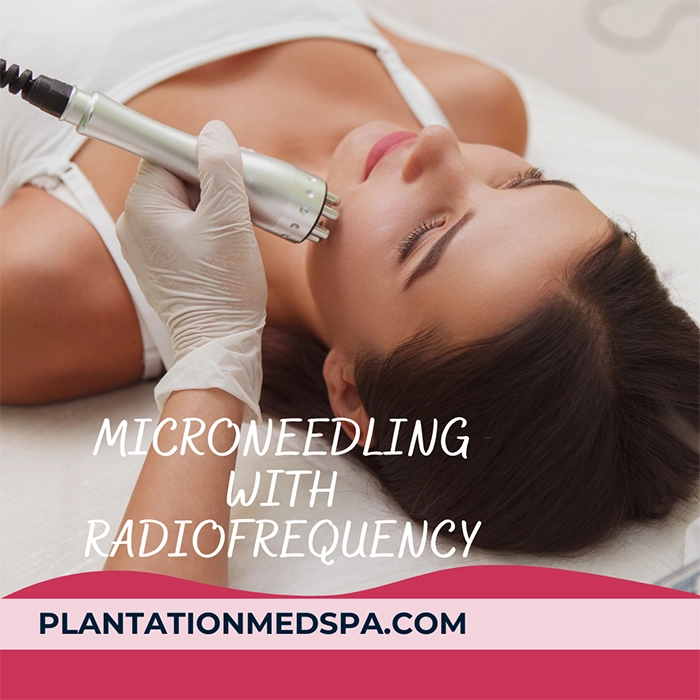 image of microneedling with radiofrequency cost in Plantation Florida