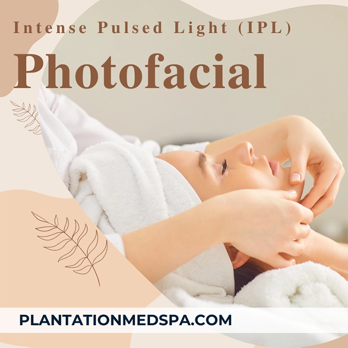 image of IPL Photofacial treatment cost in Plantation Florida