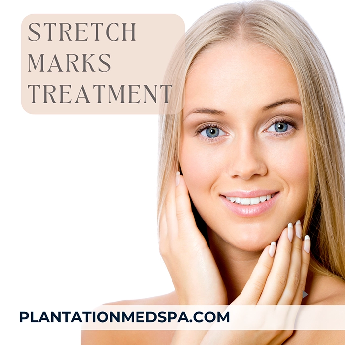 image of stretch marks treatment cost in Plantation Florida