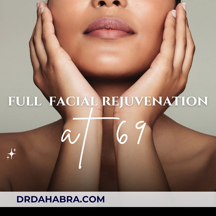 Full Facial Rejuvenation at 69 Dr. Dahabra's Filler and Botox Transformation 1 full facial rejuvenation at 69 Dr. Dahabra's filler and Botox transformation