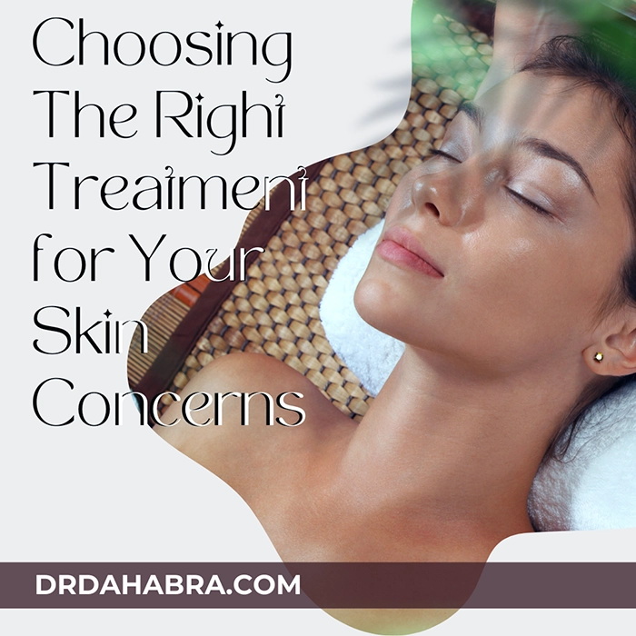 Expert Insights on Choosing the Right Treatment for Your Skin Concerns 1 Expert insights on choosing the right treatment for your skin concerns