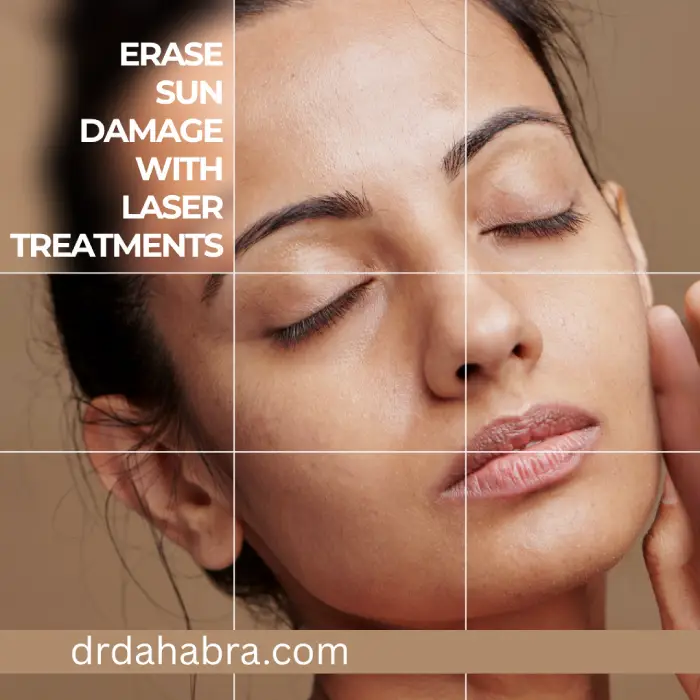 Erase Sun Damage with Laser Treatments