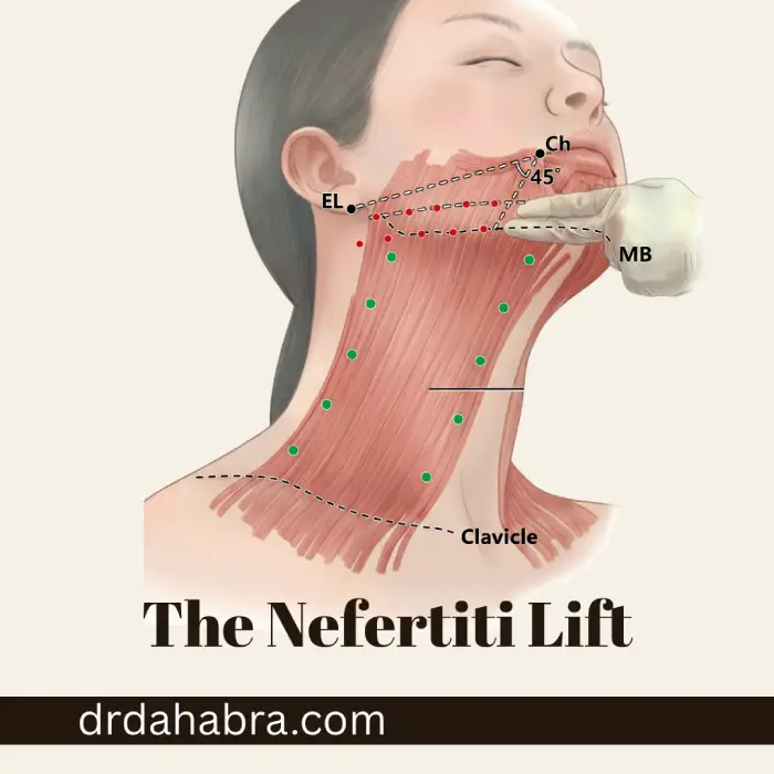 The Nefertiti Lift: How to Get a Sharp Jawline Without Surgery